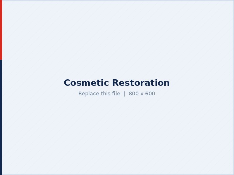 Cosmetic restoration for hand and finger