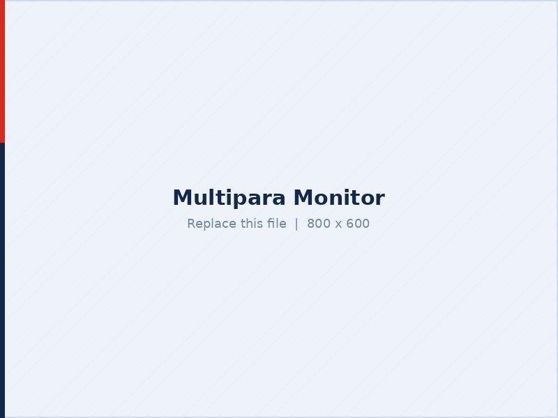 Multipara patient monitor in the ICU