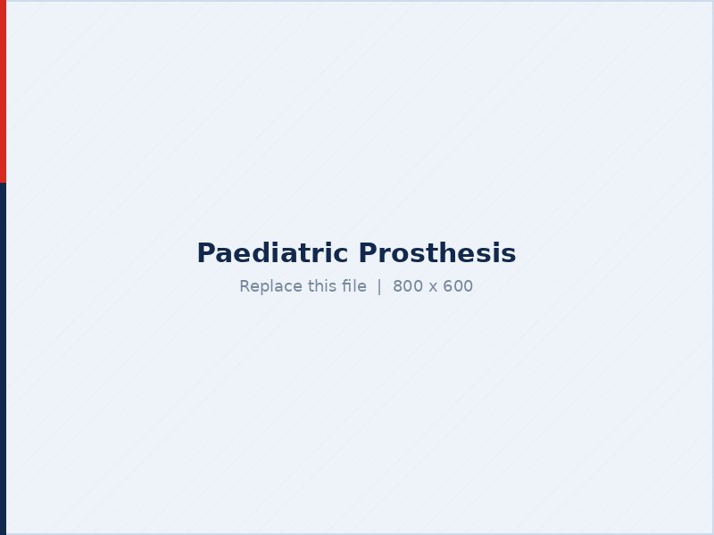 Paediatric prosthesis and orthosis for children
